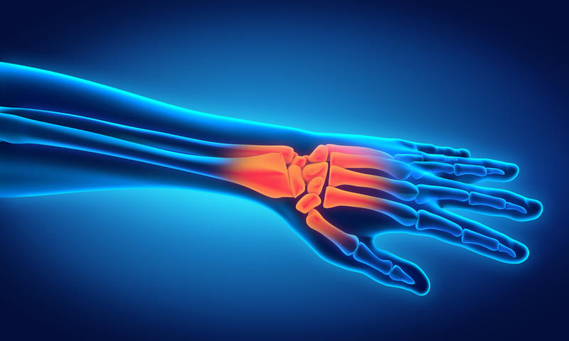 Joint pain - Credit: Shutterstock An x-ray style image of an arm, with the bones of the wrist in a fiery-orange colour